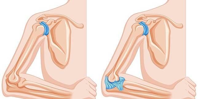 Detail Gambar Sendi Mati Nomer 56