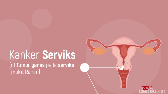 Detail Gambar Serviks Yg Sehat Nomer 13