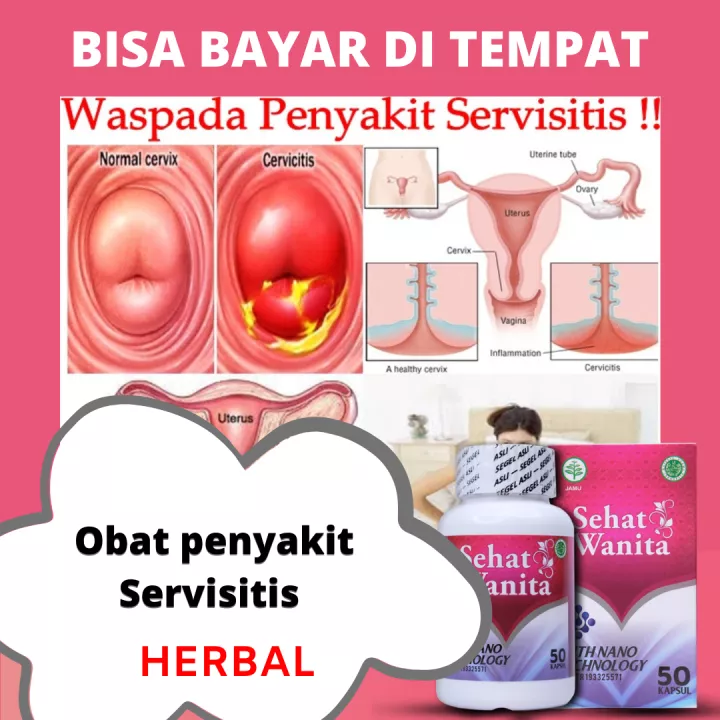 Detail Gambar Serviks Yg Sehat Nomer 15