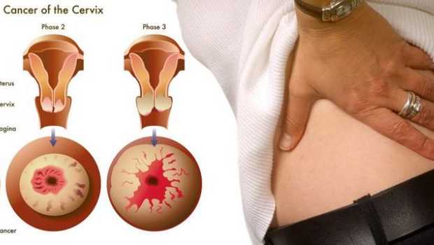Detail Gambar Serviks Yg Sehat Nomer 16