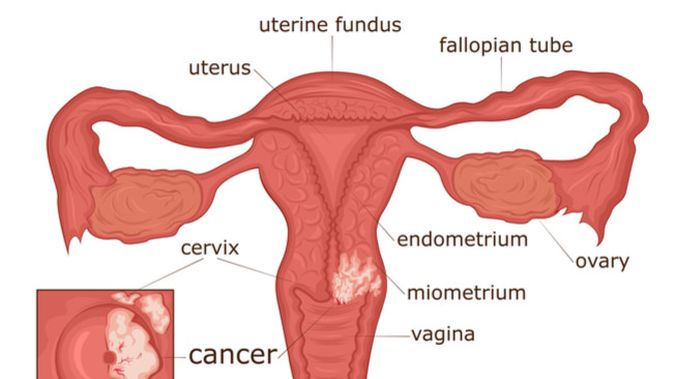 Detail Gambar Serviks Yg Sehat Nomer 19