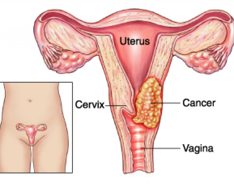 Detail Gambar Serviks Yg Sehat Nomer 21