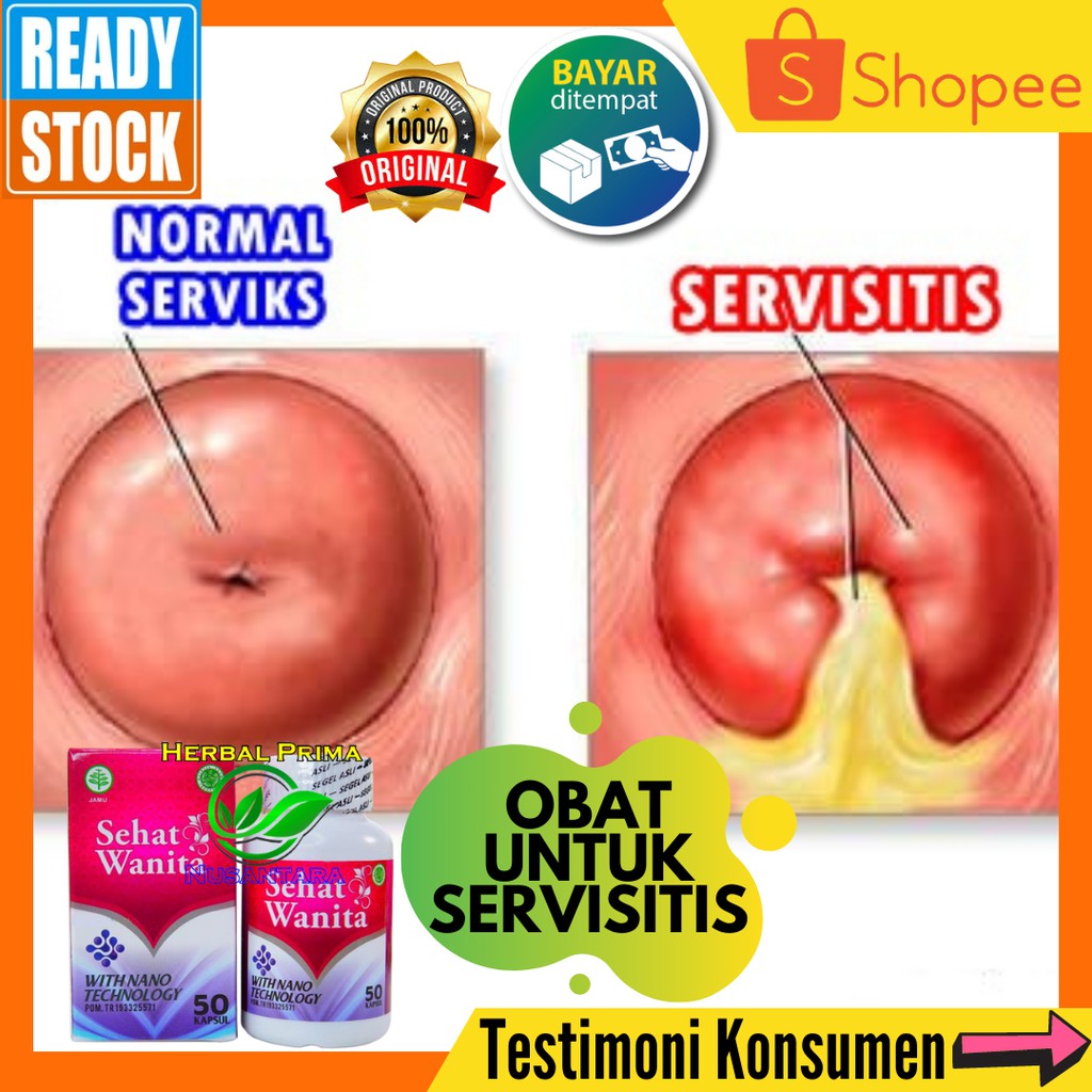 Detail Gambar Serviks Yg Sehat Nomer 27