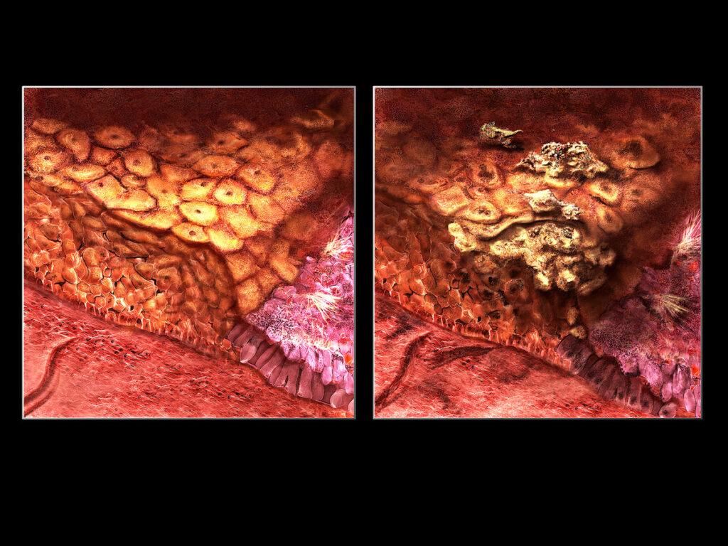 Detail Gambar Serviks Yg Sehat Nomer 39