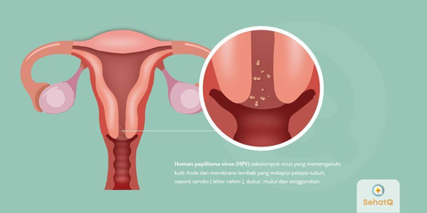 Detail Gambar Serviks Yg Sehat Nomer 40