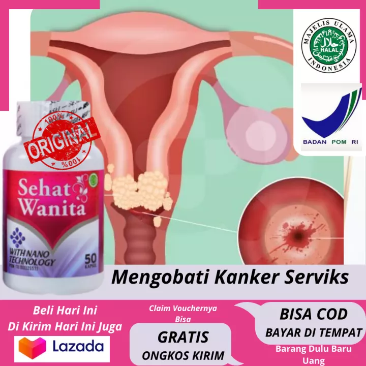 Detail Gambar Serviks Yg Sehat Nomer 42