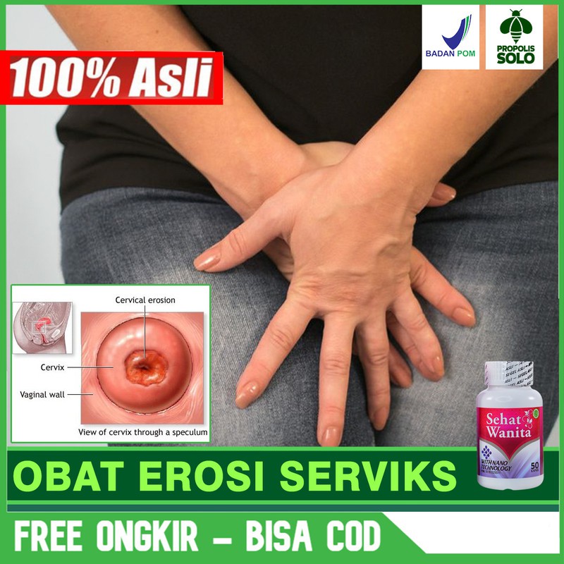 Detail Gambar Serviks Yg Sehat Nomer 52