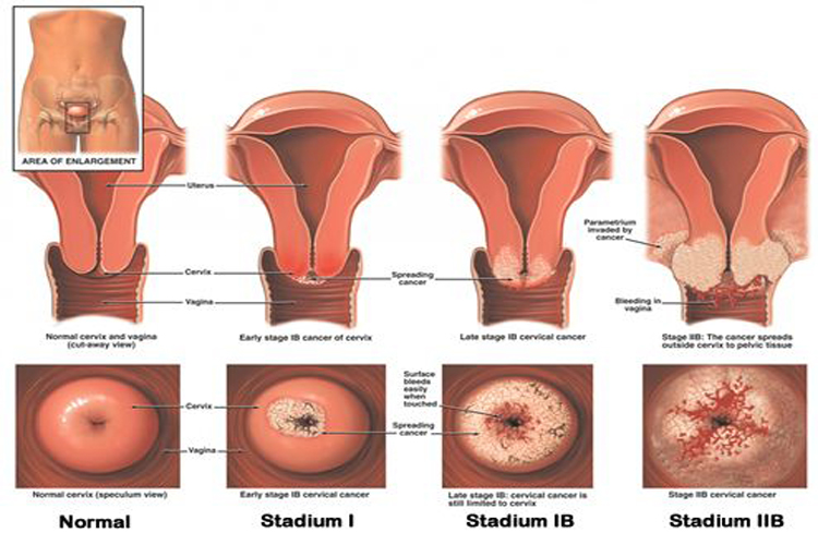 Detail Gambar Serviks Yg Sehat Nomer 7