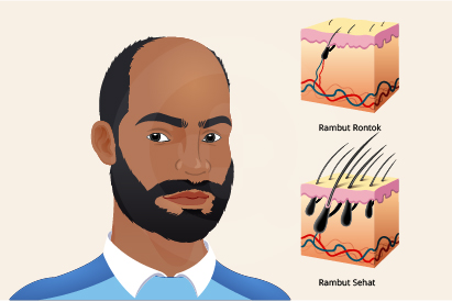 Detail Gambar Siklus Pertumbuhan Rambut Nomer 29