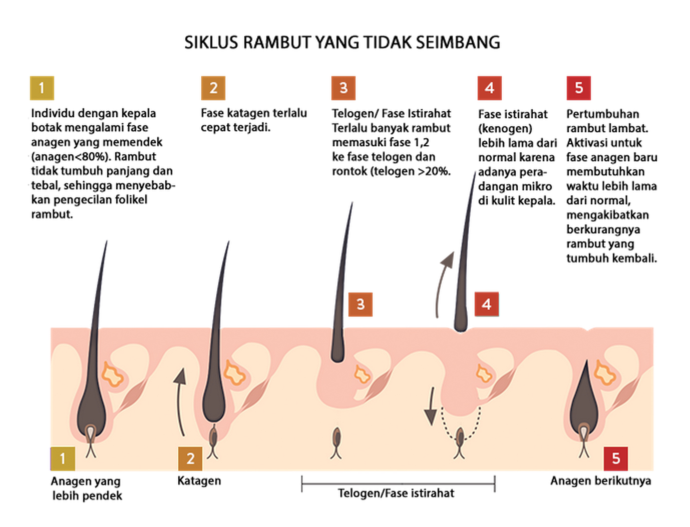 Detail Gambar Siklus Pertumbuhan Rambut Nomer 5