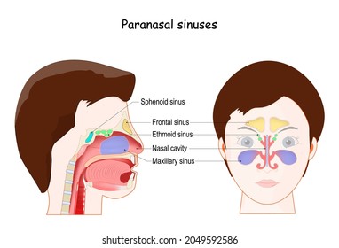 Detail Gambar Sinus Paranasal Nomer 23