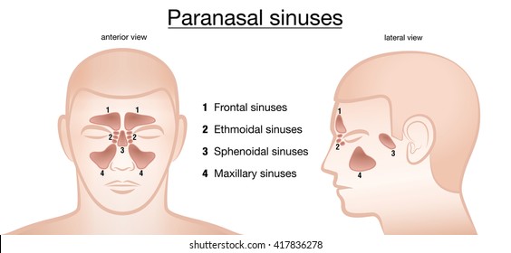 Detail Gambar Sinus Paranasal Nomer 5