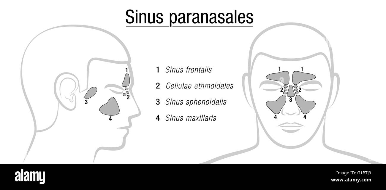 Detail Gambar Sinus Paranasal Nomer 44