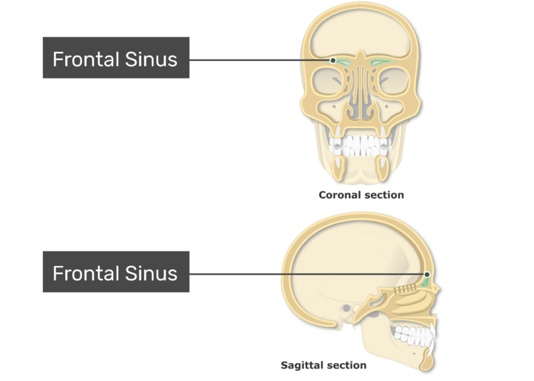 Detail Gambar Sinus Paranasal Nomer 46