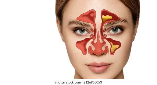 Detail Gambar Sinus Paranasal Nomer 53