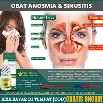 Detail Gambar Sinusitis Pada Hidung Nomer 41