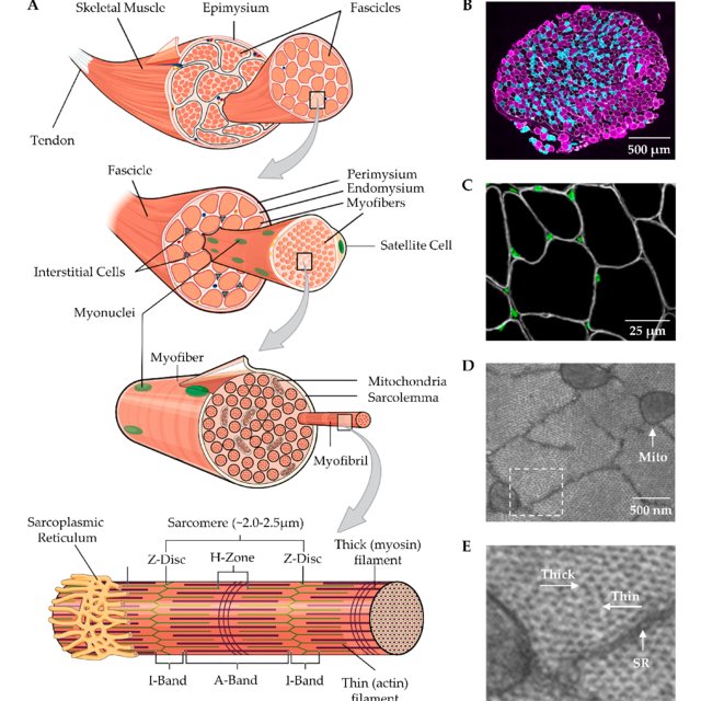 Detail Gambar Skeletal Muscle Nomer 13