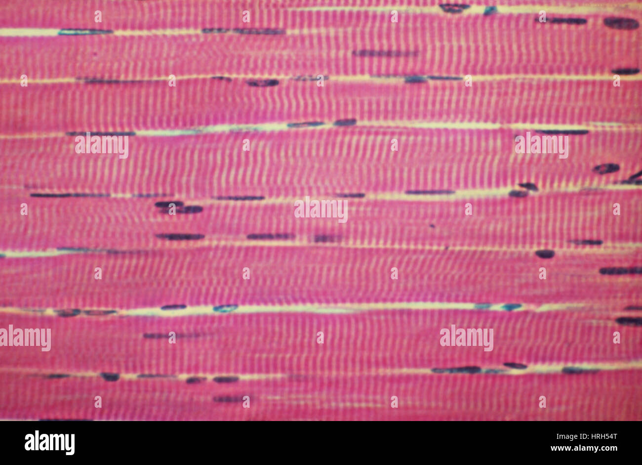 Detail Gambar Skeletal Muscle Nomer 47