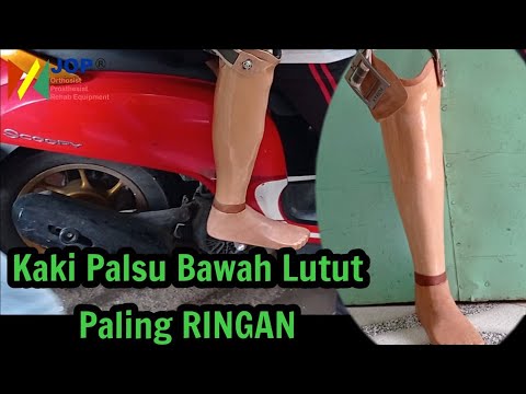 Detail Gambar Skema Pemasangan Kaki Palsu Nomer 10