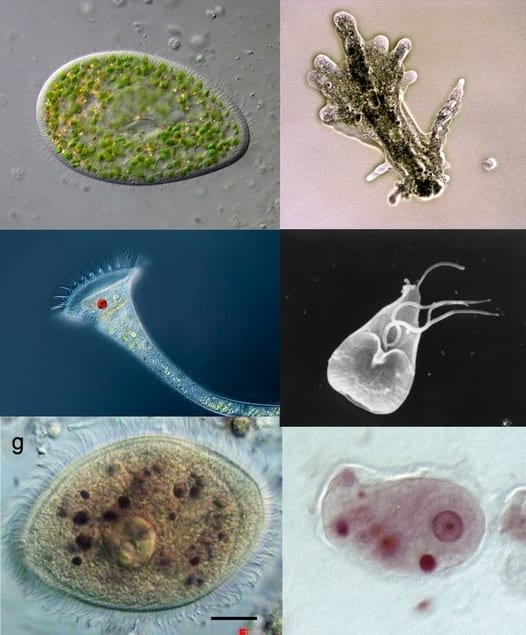 Detail Gambar Spesis Protozoa Nomer 20