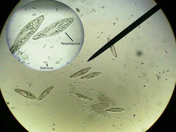 Detail Gambar Spesis Protozoa Nomer 36