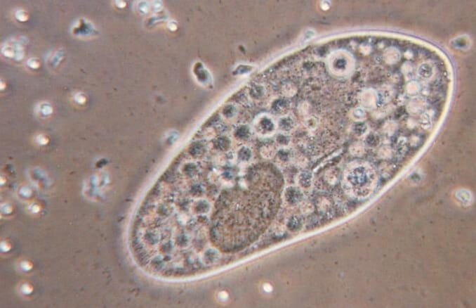 Detail Gambar Spesis Protozoa Nomer 45