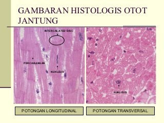 Detail Gambar Struktur Otot Jantung Nomer 16