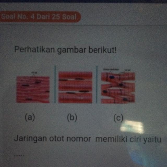 Detail Gambar Struktur Otot Polos Nomer 47