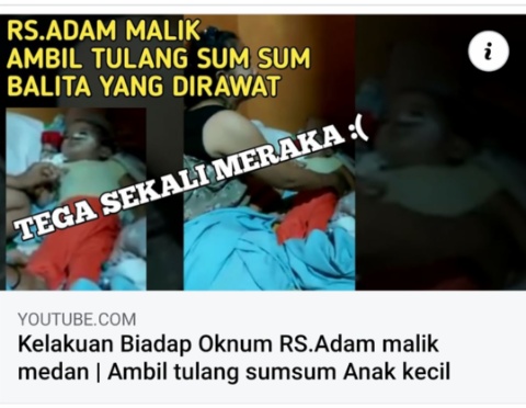 Detail Gambar Sum Sum Tulang Belakang Nomer 33