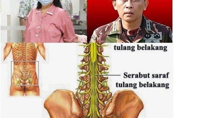 Detail Gambar Sum Sum Tulang Belakang Nomer 45