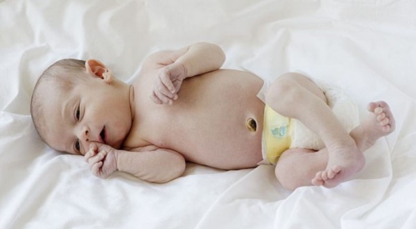 Detail Gambar Tali Pusar Bayi Infeksi Nomer 13