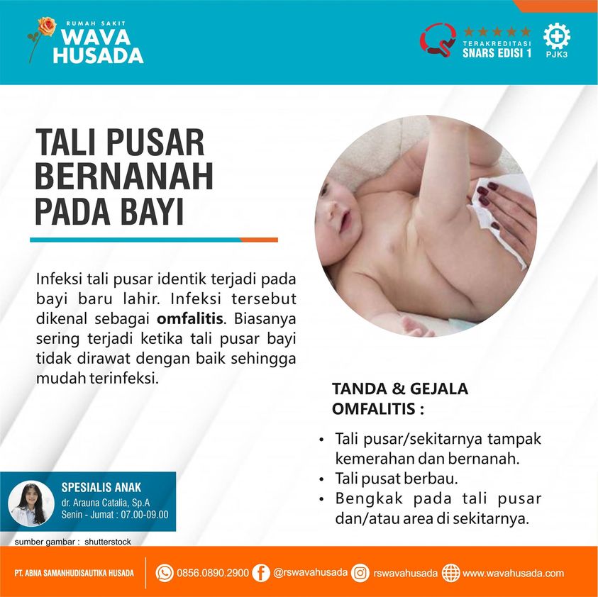 Detail Gambar Tali Pusar Bayi Infeksi Nomer 24