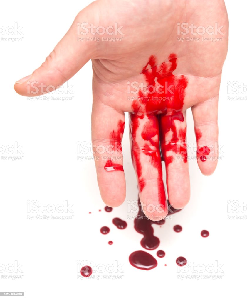 Detail Gambar Tangan Berdarah Nomer 11