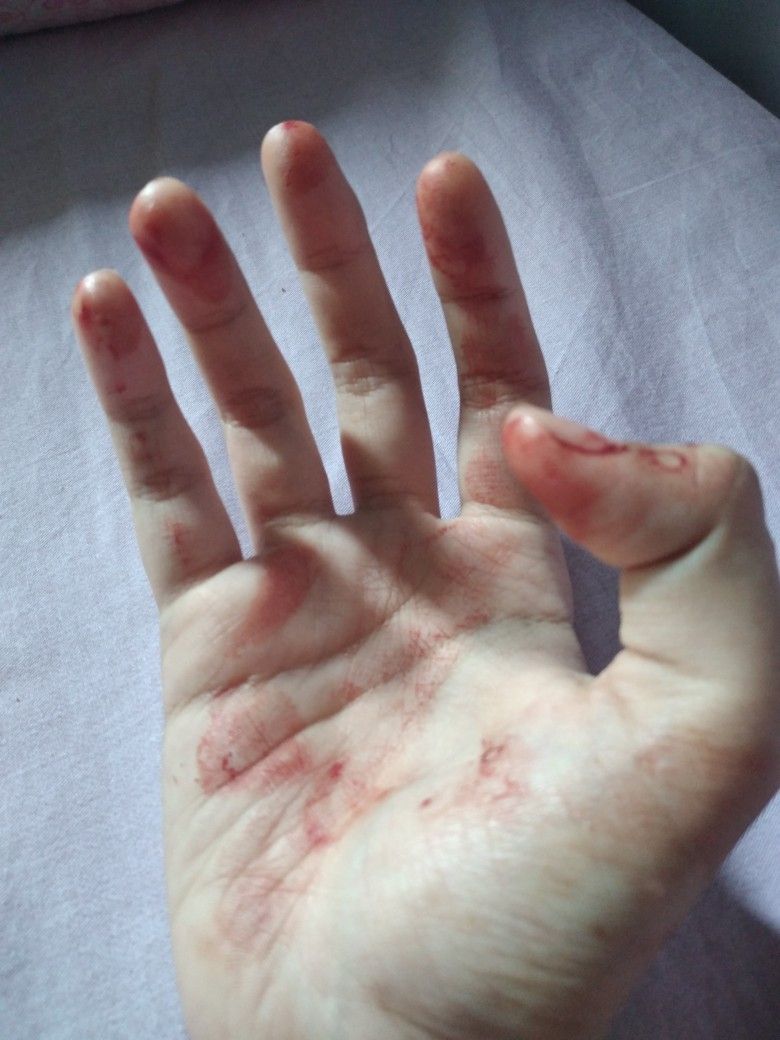 Detail Gambar Tangan Berdarah Karena Cinta Nomer 42