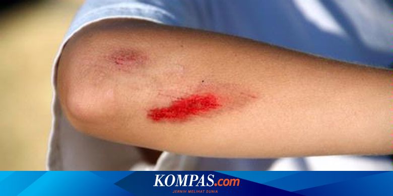 Detail Gambar Tangan Terluka Berdarah Nomer 34