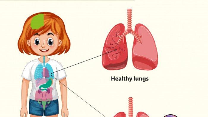 Detail Gambar Tb Pada Anak Anak Nomer 23