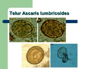 Detail Gambar Telur Ascaris Lumbricoides Nomer 8