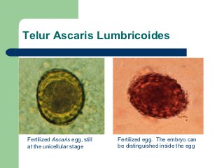 Detail Gambar Telur Ascaris Lumbricoides Nomer 9