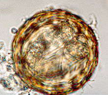 Detail Gambar Telur Ascaris Lumbricoides Nomer 11