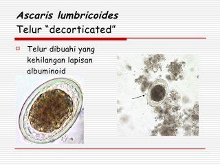 Detail Gambar Telur Ascaris Lumbricoides Nomer 13