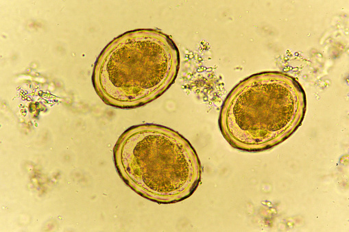 Detail Gambar Telur Ascaris Lumbricoides Nomer 24