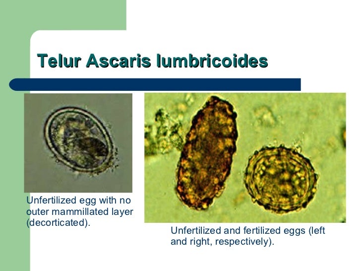 Detail Gambar Telur Ascaris Lumbricoides Nomer 35