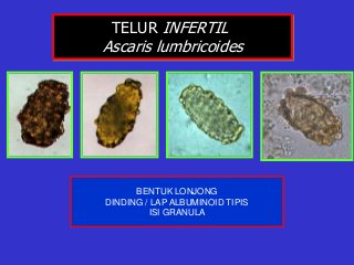 Detail Gambar Telur Ascaris Lumbricoides Nomer 38