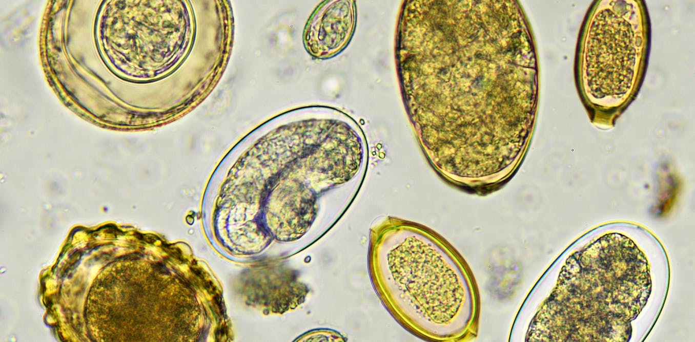 Detail Gambar Telur Ascaris Lumbricoides Nomer 39