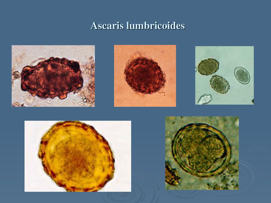 Detail Gambar Telur Ascaris Lumbricoides Nomer 42