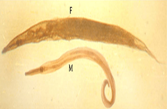 Detail Gambar Telur Ascaris Lumbricoides Nomer 44