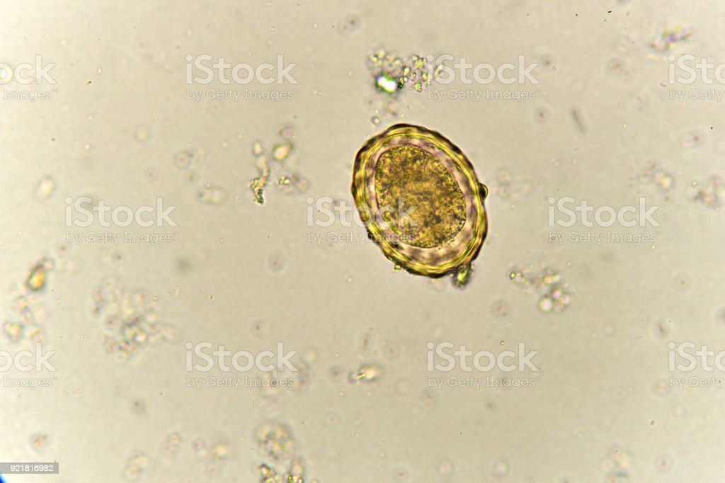 Detail Gambar Telur Ascaris Lumbricoides Nomer 6
