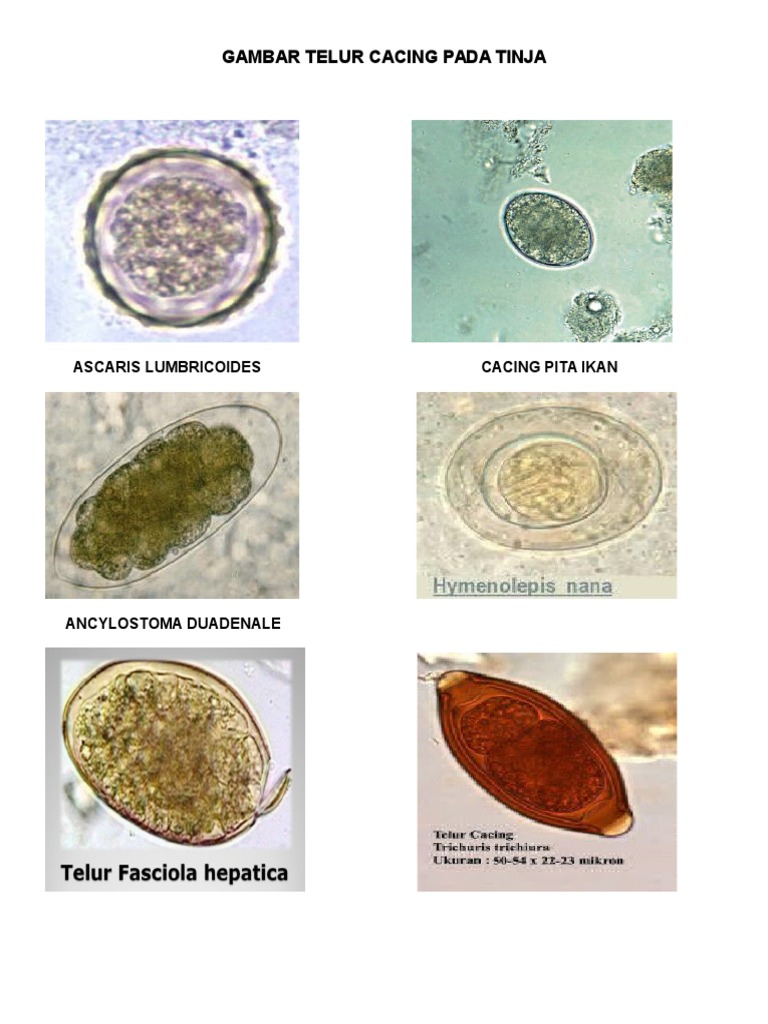 Detail Gambar Telur Cacing Nomer 11