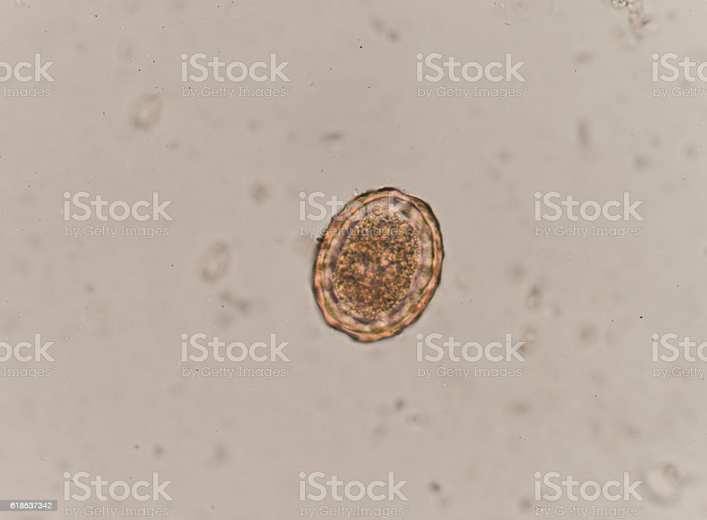 Detail Gambar Telur Cacing Nomer 18