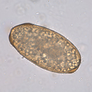Detail Gambar Telur Cacing Ascaris Lumbricoides Nomer 8